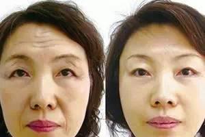 林青霞60岁依旧做女神 谱写美丽攻略！