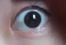 美瞳线掉痂，我扣了一下，结果不上色了！