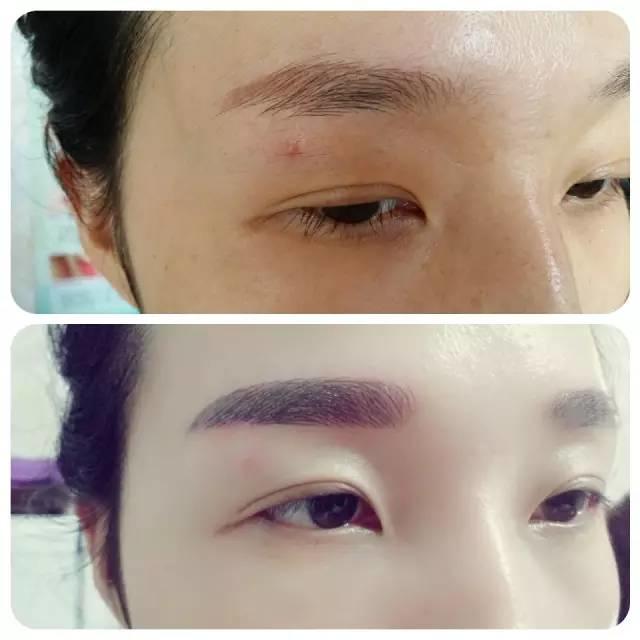 美瞳线掉痂，我扣了一下，结果不上色了！