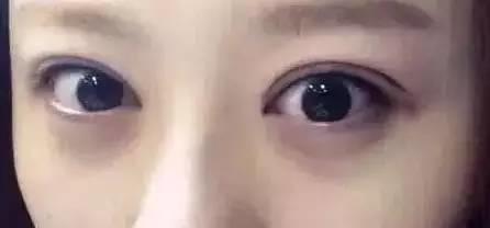 美瞳线掉痂，我扣了一下，结果不上色了！