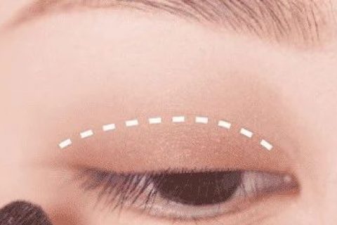 眼睛变肿该怎么化妆？